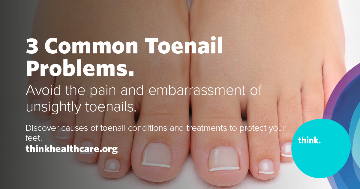 Thick Toenails  Causes, Treatment & Remedies
