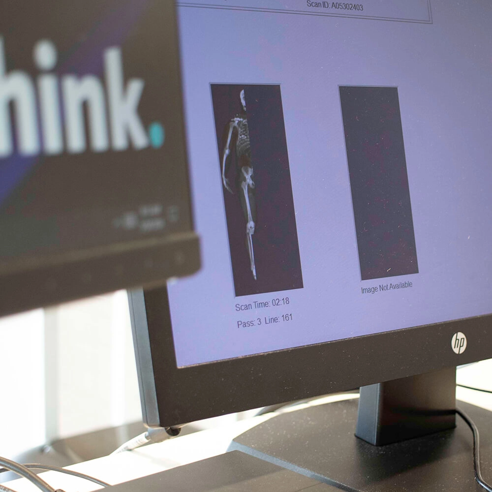 A computer monitor displays a skeletal scan image and a placeholder reading Image Not Available. Part of another monitor with the word think. is visible on the left. Both monitors are on an office desk.