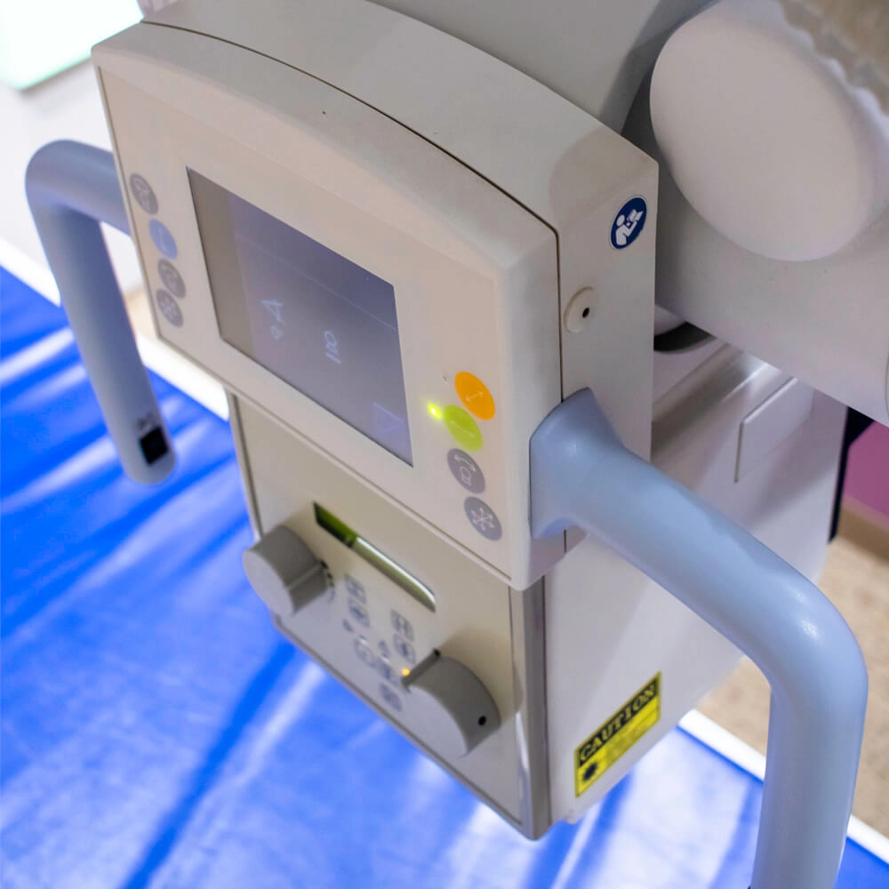 Close-up of an X-ray machine control panel with a screen and buttons, featuring two blue handles on each side. A Caution sticker is visible near the bottom of the machine.