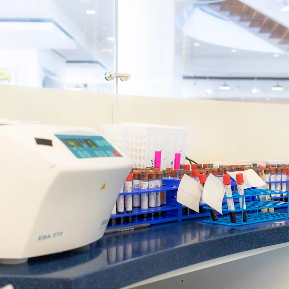 Blood sample vials in blue racks sit on a lab counter next to a medical centrifuge, with a bright, modern laboratory environment in the background.
