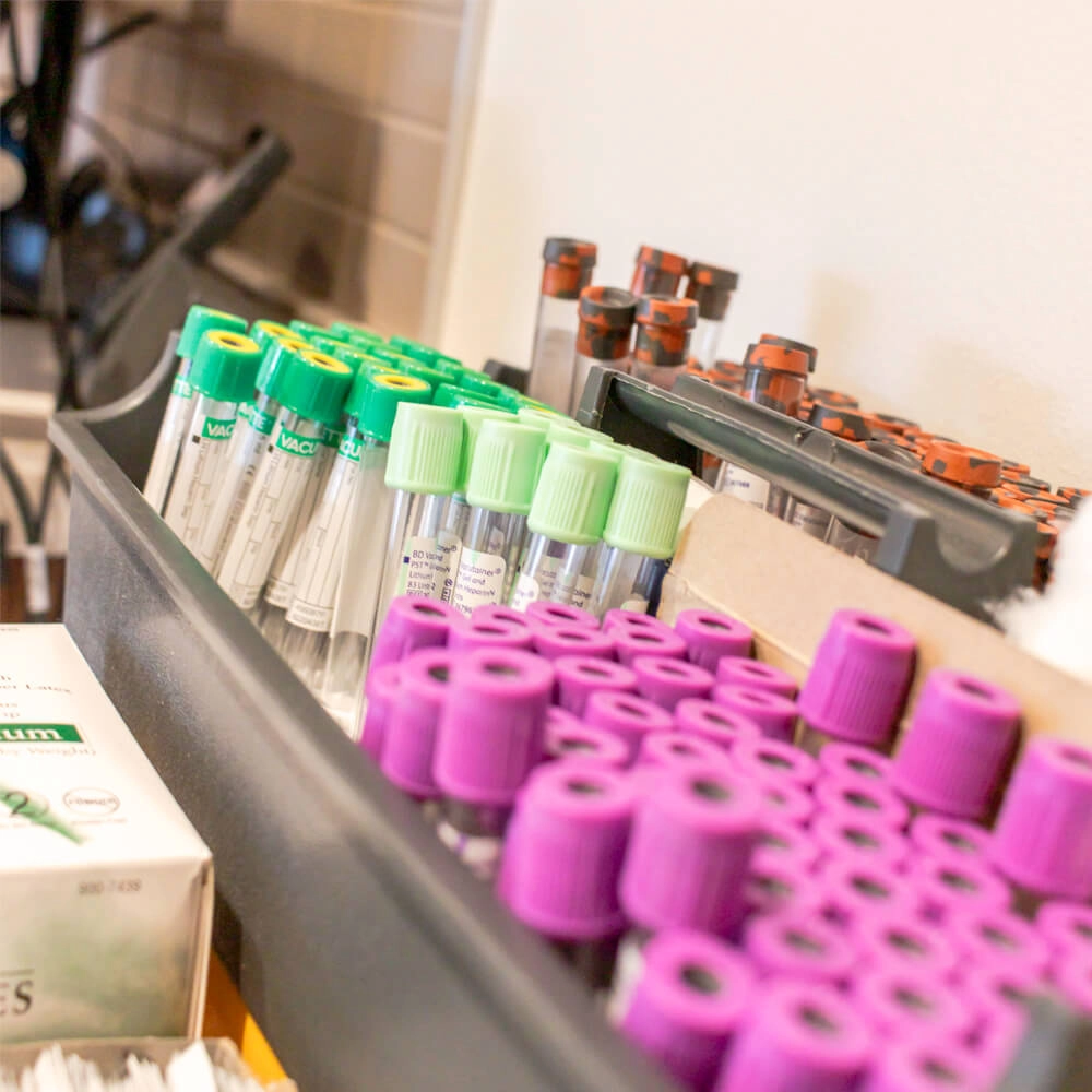 Assorted blood collection tubes with colored caps (purple, green, and orange) organized in rows on a tray in a clinical or laboratory setting.