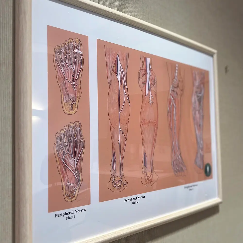 Framed medical illustration showing detailed diagrams of the peripheral nerves in the human foot and leg, with anatomical labels, displayed on a beige wall.